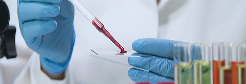 Clinical Chemistry and Immunoassay Analyzers