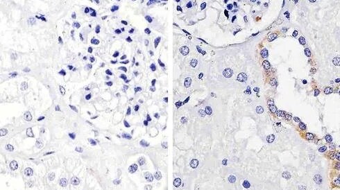 Primary Antibodies for ELISA