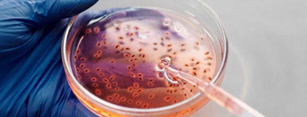 Lignées cellulaires et culture cellulaire