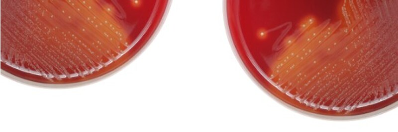 Acute Pharyngitis Pathogen Identification Webinar