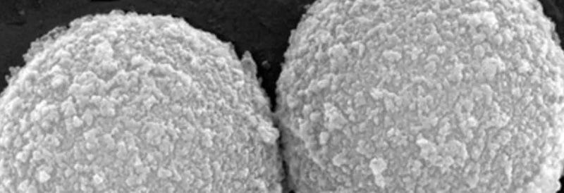 Cytiva Sera-Mag SpeedBeads™ Protein A/G Magnetic Beads