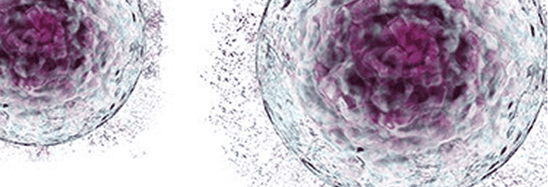 Les difficultés liées à l’équipement dans le cadre de la transition vers une production de masse dans les processus de thérapie cellulaire