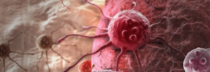 L'histoire du cancer - la thérapie cellulaire T CAR