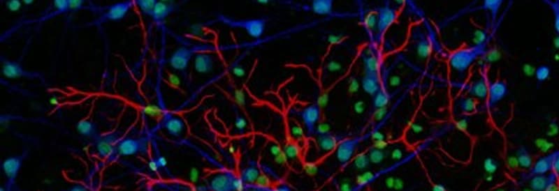 Avancées technologiques en microscopie à fluorescence