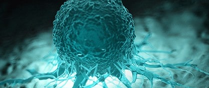 Des “avatars de tumeurs” pourraient aider à identifier des traitements efficaces contre le cancer