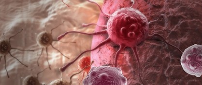 L'histoire du cancer - la thérapie cellulaire T Car